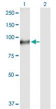 Anti-TGM1 Rabbit Polyclonal Antibody