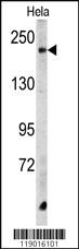 Anti-CPD Rabbit Polyclonal Antibody