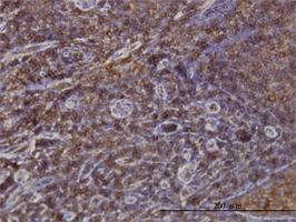 Anti-SNX1 Mouse Monoclonal Antibody [clone: 6H1]