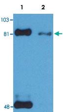 Anti-STAT1 Monoclonal Antibody [clone: PSM1]