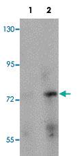 Anti-PIAS2 Rabbit Polyclonal Antibody