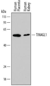 Anti-TINAGL1 Mouse Monoclonal Antibody [clone: 812417]