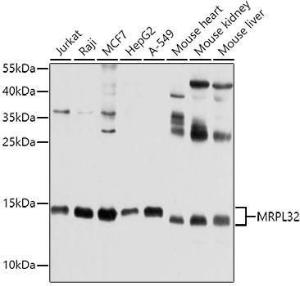 Western blot analysis of extracts of various cell lines, using Anti-MRPL32 Antibody (A11215) at 1:1,000 dilution. The secondary antibody was Goat Anti-Rabbit IgG H&L Antibody (HRP) at 1:10,000 dilution.