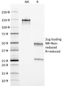 SDS-PAGE analysis of Anti-Ferritin Light Chain Antibody [FTL/1389] under non-reduced and reduced conditions; showing intact IgG and intact heavy and light chains, respectively. SDS-PAGE analysis confirms the integrity and purity of the antibody.