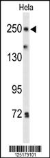 Anti-PTPRD Rabbit Polyclonal Antibody