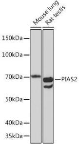 Anti-PIAS2 Rabbit Monoclonal Antibody [clone: ARC1256]