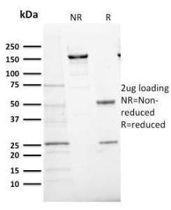 SDS-PAGE analysis of Anti-Ki67 Antibody [MKI67/2466] under non-reduced and reduced conditions; showing intact IgG and intact heavy and light chains, respectively SDS-PAGE analysis confirms the integrity and purity of the antibody