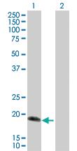 Anti-IL17C Rabbit Polyclonal Antibody