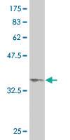 Anti-RPS6KB1 Mouse Monoclonal Antibody [clone: 4H4]