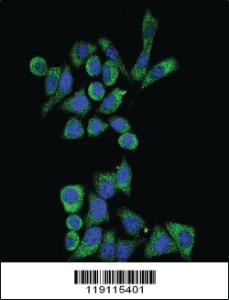 Anti-GLA Rabbit Polyclonal Antibody