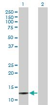 Anti-SAA4 Rabbit Polyclonal Antibody