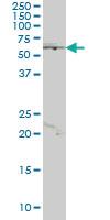 Anti-JRKL Mouse Monoclonal Antibody [clone: 4E10]