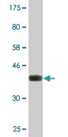 Anti-RNF25 Mouse Monoclonal Antibody [clone: 1D10]