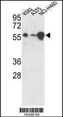 Anti-USP3 Rabbit Polyclonal Antibody (AP (Alkaline Phosphatase))