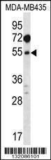 Anti-MAT1A Rabbit Polyclonal Antibody (FITC (Fluorescein Isothiocyanate))