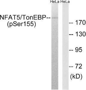 Anti-NFAT5