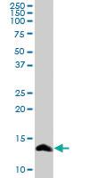 Anti-SAA4 Rabbit Polyclonal Antibody