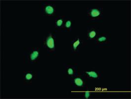 Anti-TBX6 Mouse Monoclonal Antibody [clone: 1D11]