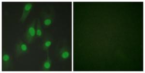 Immunofluorescence analysis of HeLa cells using Anti-Chk1 Antibody. The right hand panel represents a negative control, where the antibody was pre-incubated with the immunising peptide.