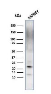 Western blot analysis of kidney tissue lysate using Anti-Ferritin Light Chain Antibody [FTL/1389]