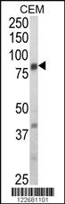 Anti-BRAF Rabbit Polyclonal Antibody