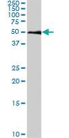 Anti-SMAD1 Mouse Monoclonal Antibody [clone: 2E9]