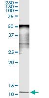 Anti-SAA4 Mouse Monoclonal Antibody [clone: 3C11]