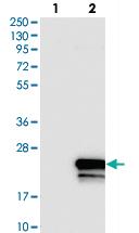 Anti-SLC51B Rabbit Polyclonal Antibody