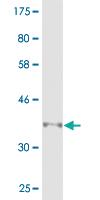 Anti-MMRN1 Mouse Monoclonal Antibody [clone: 1G10]