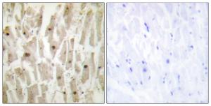 Immunohistochemical analysis of paraffin-embedded human heart tissue using Anti-TSH1 Antibody. The right hand panel represents a negative control, where the antibody was pre-incubated with the immunising peptide