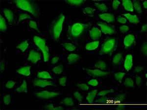 Anti-RRM2 Mouse Monoclonal Antibody [clone: 1E1]