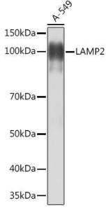 Western blot analysis of extracts of A-549 cells, using Anti-LAMP2 Antibody [ARC0274] (A305918) at 1:1,000 dilution