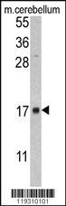 Anti-FKBP2 Rabbit Polyclonal Antibody