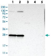 Anti-MRPL9 Rabbit Polyclonal Antibody