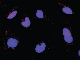 Anti-PPM1B + CHUK Antibody Pair