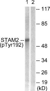 Western blot analysis of lysates from NIH/3T3 cells treated with EGF 200ng/ml 30' using Anti-STAM2 (phospho Tyr192) Antibody. The right hand lane represents a negative control, where the antibody is blocked by the immunising peptide.