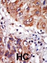 Anti-LIM Kinase 1 (LIMK1) Rabbit Polyclonal Antibody