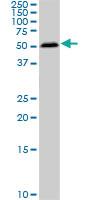 Anti-SMAD1 Mouse Monoclonal Antibody [clone: 2E9]