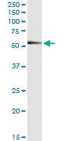 Anti-RNF25 Polyclonal Antibody Pair