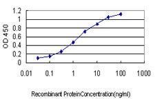 Anti-RRM2 Mouse Monoclonal Antibody [clone: 1E1]