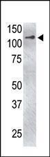 Anti-USP4 Rabbit Polyclonal Antibody (APC (Allophycocyanin))