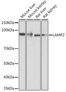 Western blot analysis of extracts of various cell lines, using Anti-LAMP2 Antibody [ARC0274] (A305918) at 1:1,000 dilution