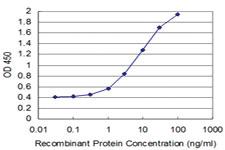 Anti-TBX6 Mouse Monoclonal Antibody [clone: 3G9]