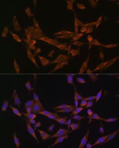 Immunofluorescence analysis of HeLa cells using Anti-UBE2O Antibody (A11220) at a dilution of 1:100 (40x lens). DAPI was used to stain the cell nuclei (blue)