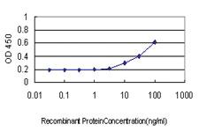 Anti-CX3CR1 Mouse Monoclonal Antibody [clone: 2B11]