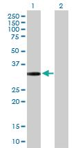 Anti-GPRC5D Mouse Polyclonal Antibody