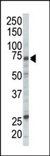 Anti-RAF1 Rabbit Polyclonal Antibody