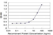 Anti-CX3CR1 Mouse Monoclonal Antibody [clone: 10D5]