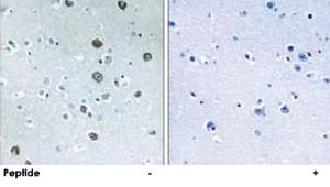 Anti-MARCH2 Rabbit Polyclonal Antibody