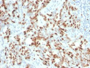 Anti-Ki67 Rabbit Recombinant Antibody [clone: MKI67/4945R]